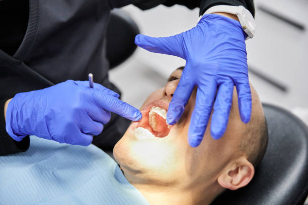 Best Emergency Broken Tooth Repair in Greenport West, NY